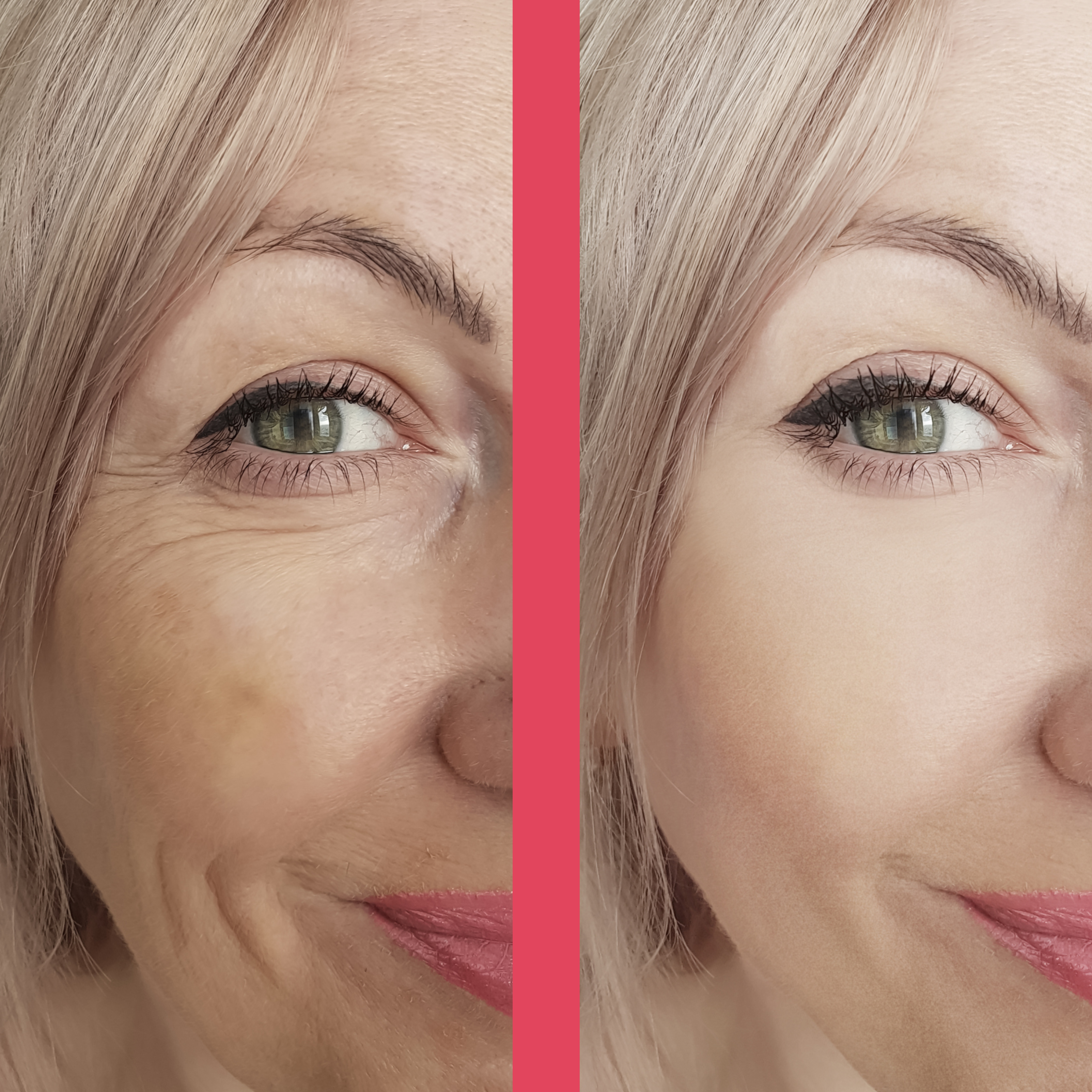 GlowLift Pro™