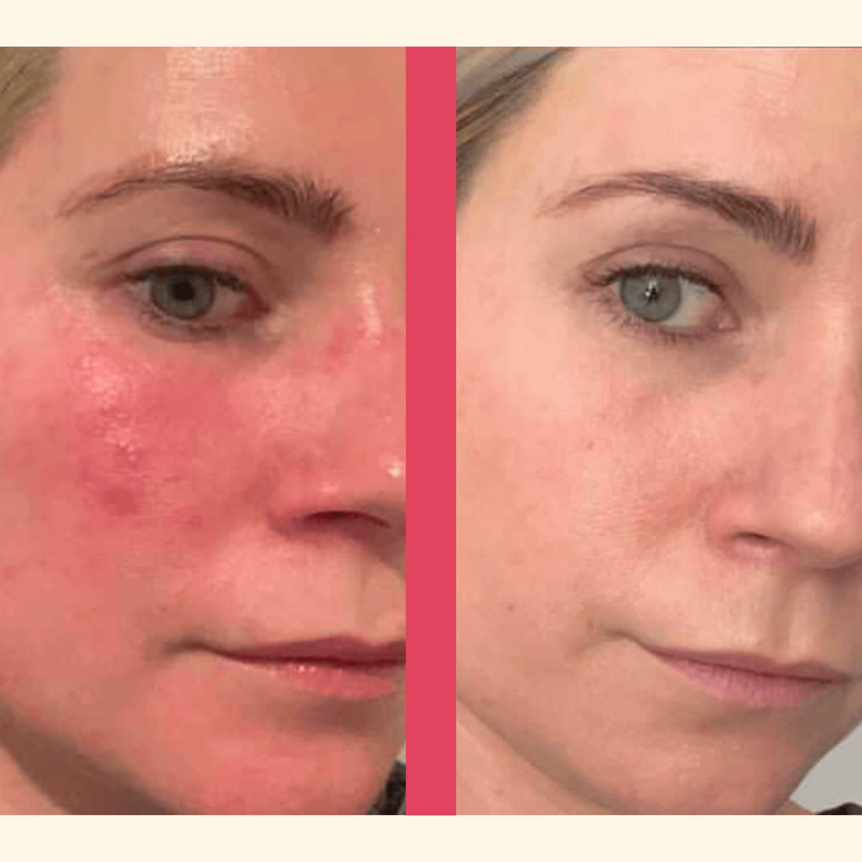 GlowLift Pro™