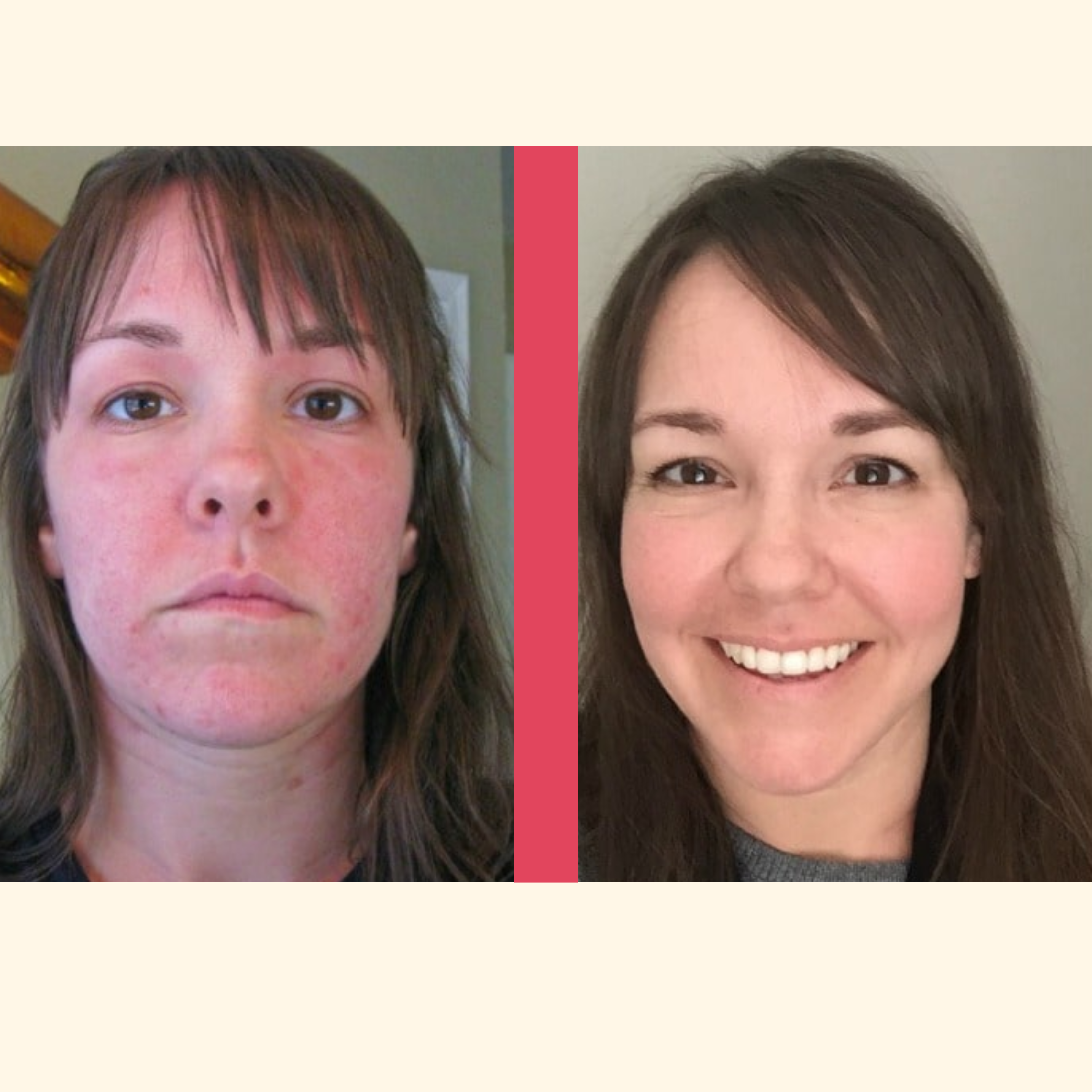 GlowLift Pro™